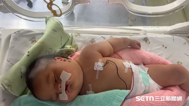 女兒產檢出唇腭裂　浪子回頭新手爸：她選擇了我們，就該好好養