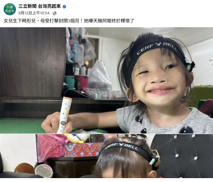 女兒生下畸形兒，母受打擊封閉3個月！她曝天機阿嬤終於釋懷了