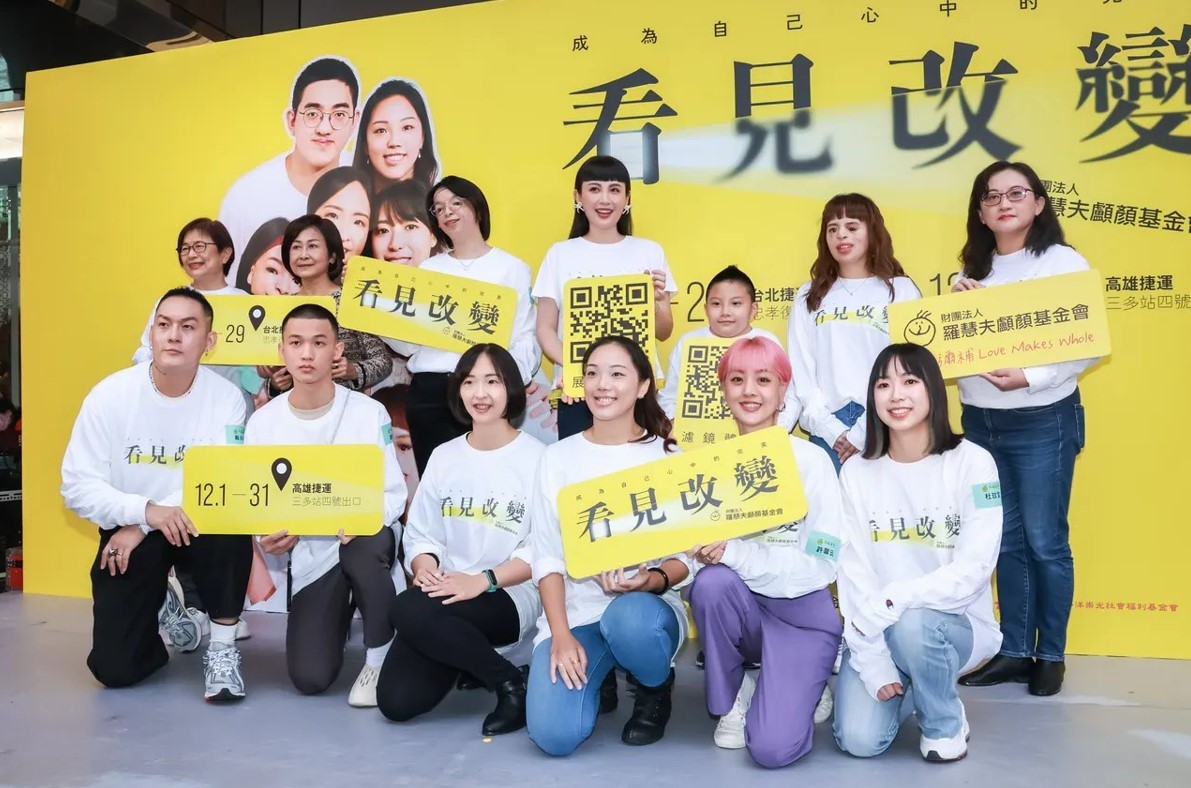 【壹蘋新聞網】羅慧夫基金會攝影展開跑 盼讓社會看見顱顏兒勇於「改變」