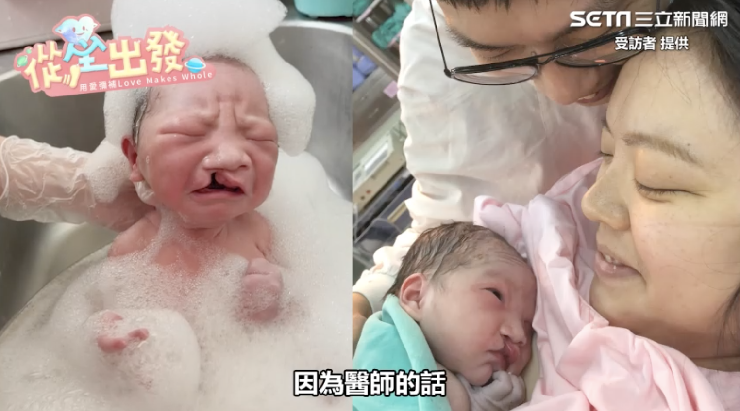 【三立新聞/LINE TODAY影音】懷了唇顎裂寶寶該生嗎？女星張寗2年後再遇他們一家 這句話讓人哭了