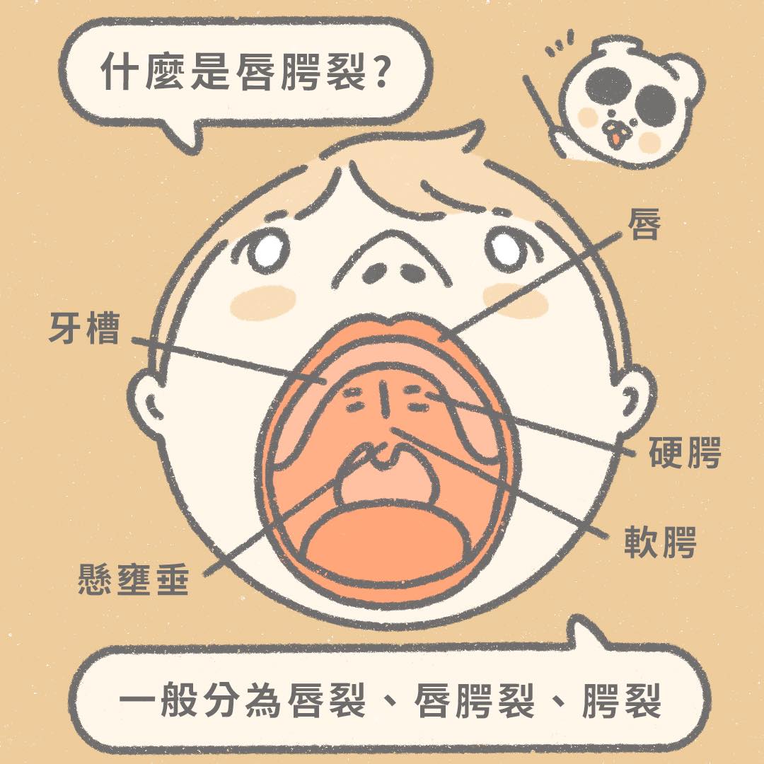 認識唇腭裂