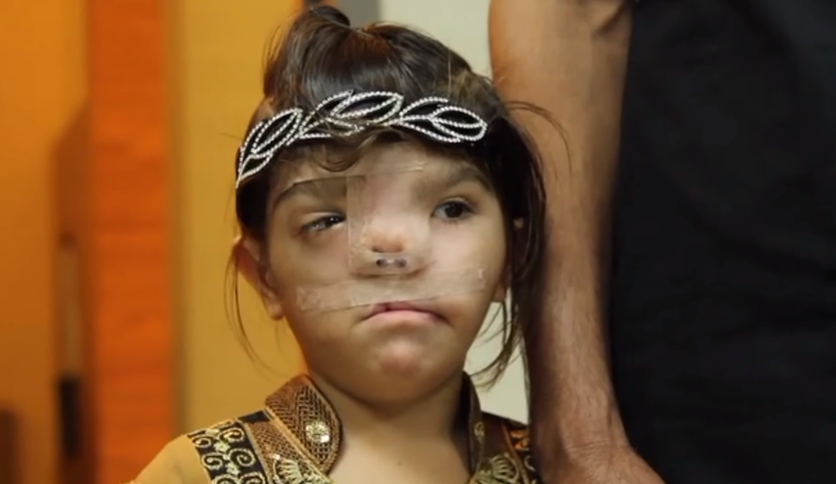 The Life-Changing Trip in Taiwan of A Pakistani Cleft Girl Bibi in 2012