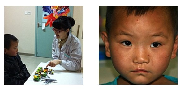 西安交通大学口腔醫院語言治療故事：家長的信任和堅持是成功的第一步