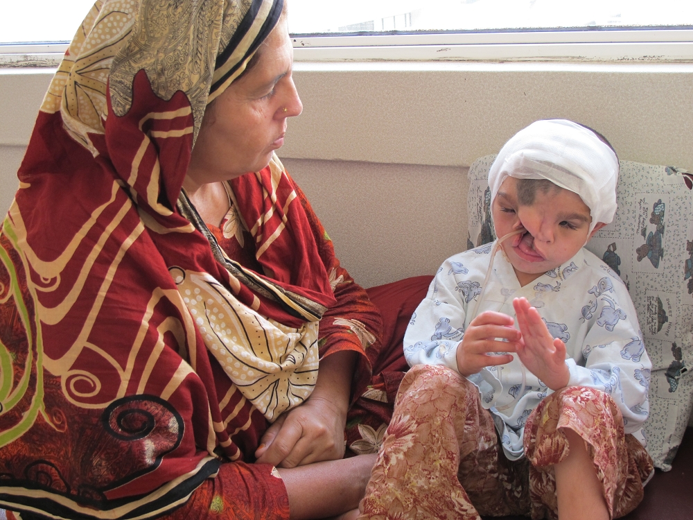 《愛。無聲》巴基斯坦顱顏患童碧碧來台