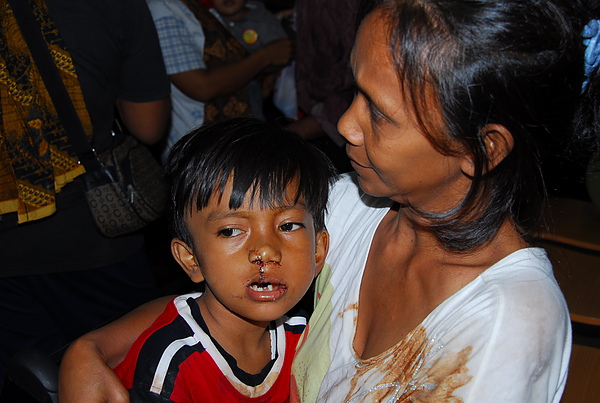 《雨城的陽光男孩》印尼加百利