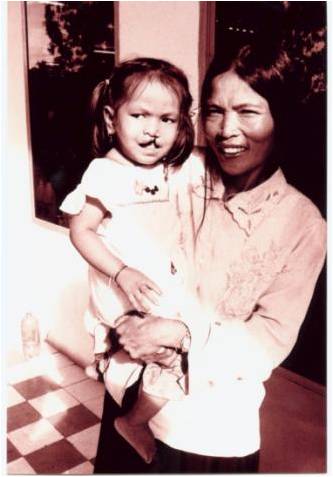 手術前2000 手術前2000