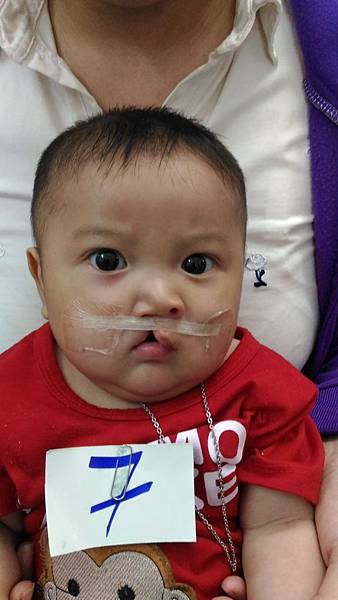愛笑的唇顎裂天使--劉楊志心(Luu Duong Chi Tam)