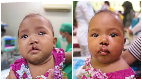 Ainun小妹妹.jpg Ainun小妹妹.jpg